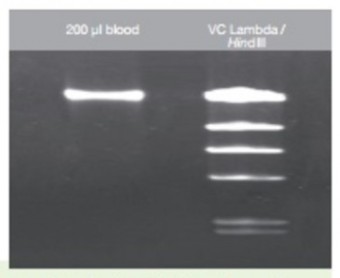 KIT DE PURIFICACION DE DNA 100Pbas Vivantis