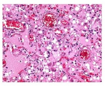 Parafina para histologia 2.5kg en pastillas  MERCK